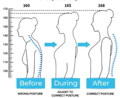 Postrex™ Precision Alignment. All-Day Comfort.