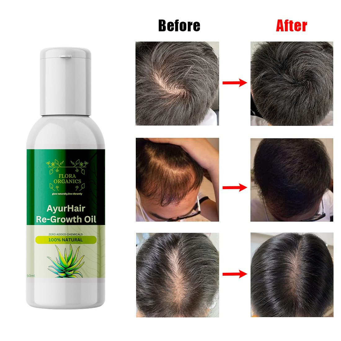 ForaOrganics Herbal Hair Restoration Formula ( Buy 1 get 1 free )