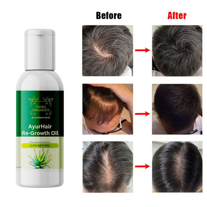ForaOrganics Herbal Hair Restoration Formula ( Buy 1 get 1 free )